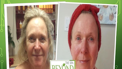 # 1 Specialized in Hifu Ultherapy Face & Neck Lift Trial 9